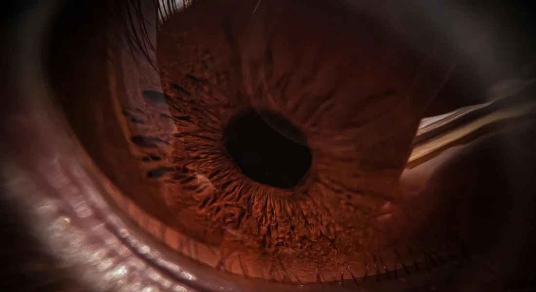 Close-up of a guinea pig's eye showing a reddish iris and dark pupil